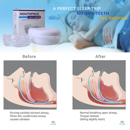 New Mouth Guard Anti-Snoring